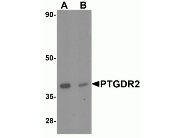 Western blot analysis of PTGDR2