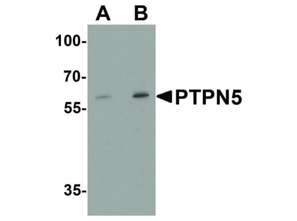 Western Blot of PTPN5 Antibody