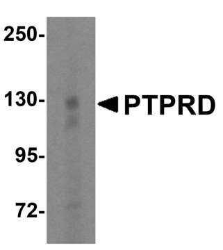 Western blot analysis of PTPRD