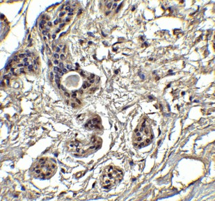 Immunohistochemistry of PUMA