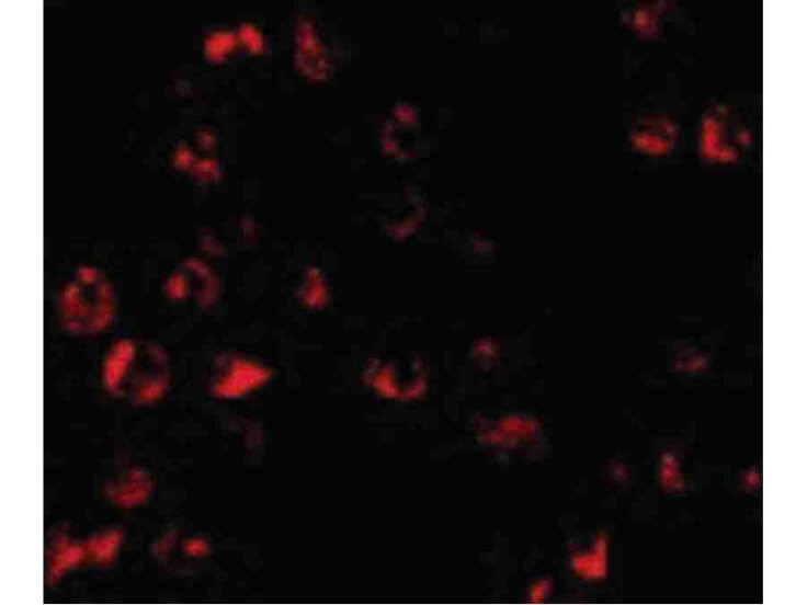 Immunofluorescence of PUMA Antibody