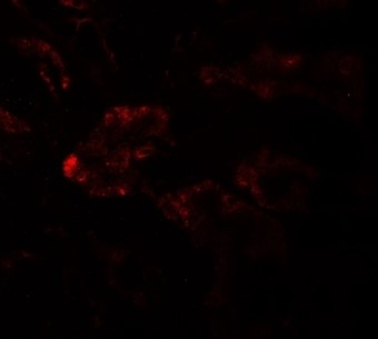 Immunofluorescence of RAB21.