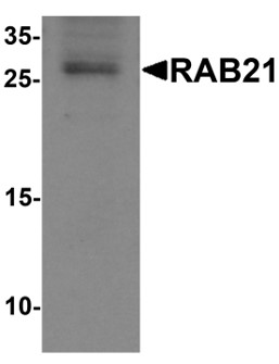 Western blot analysis of RAB21.
