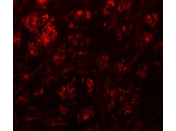 Immunofluorescence of RABEX5