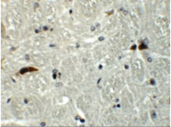 Immunohistochemistry of RABEX5