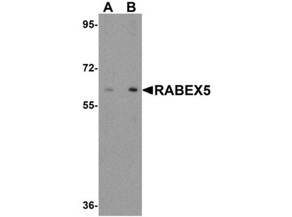 Western blot analysis of RABEX5