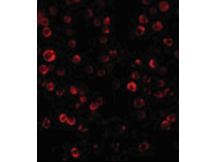 Immunofluorescence of RAIDD Antibody