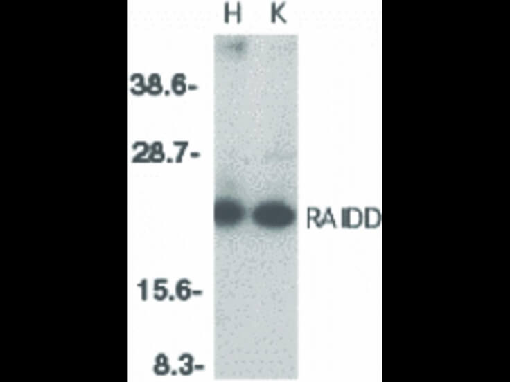 Western Blot of RAIDD Antibody