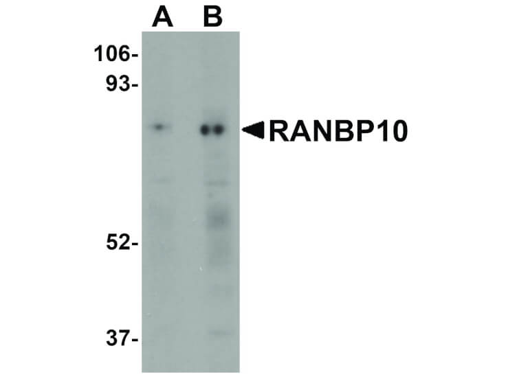 Western Blot of RANBP10 Antibody