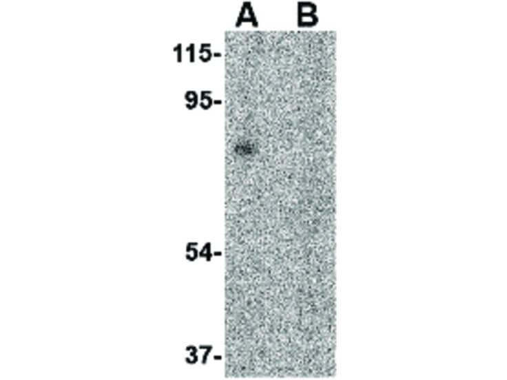 Western Blot of RAP80 Antibody