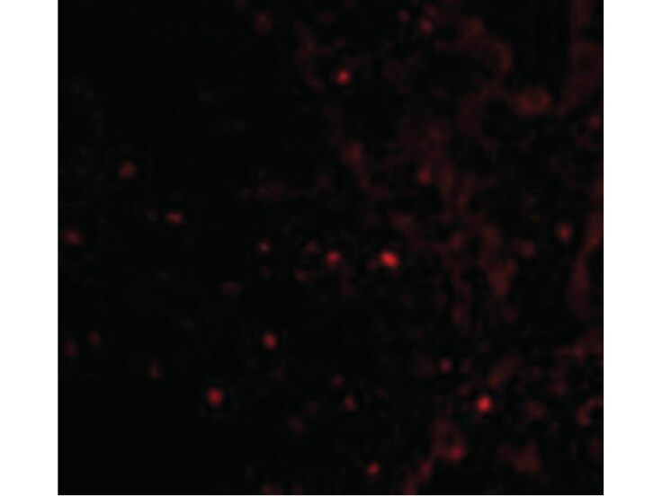 Immunofluorescence of RAP80 Antibody