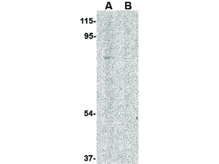 Western Blot of RAP80 Antibody