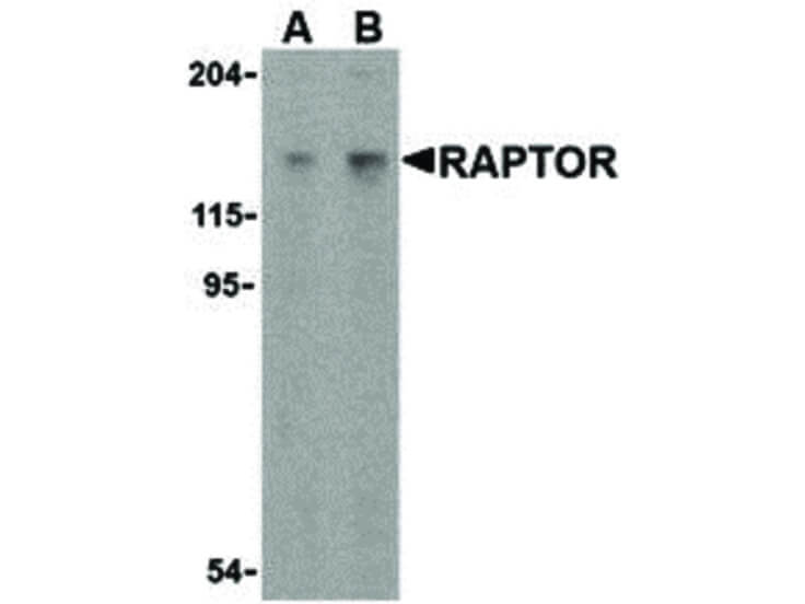 Western Blot of Raptor Antibody