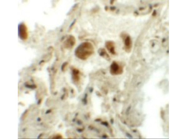 Immunohistochemistry of RASSF10.