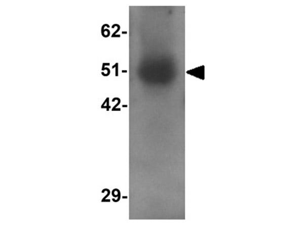 Western blot analysis of RASSF10