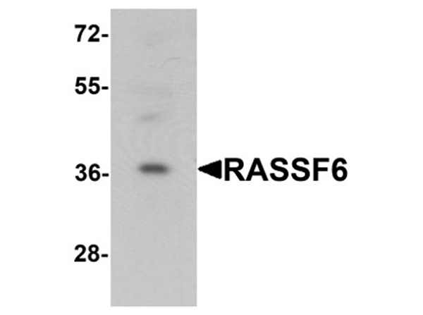 Western blot analysis of RASSF6