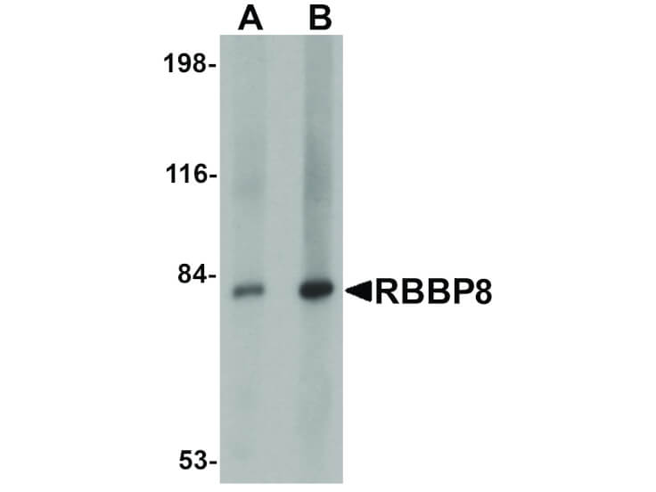 Western Blot of RBBP8 Antibody