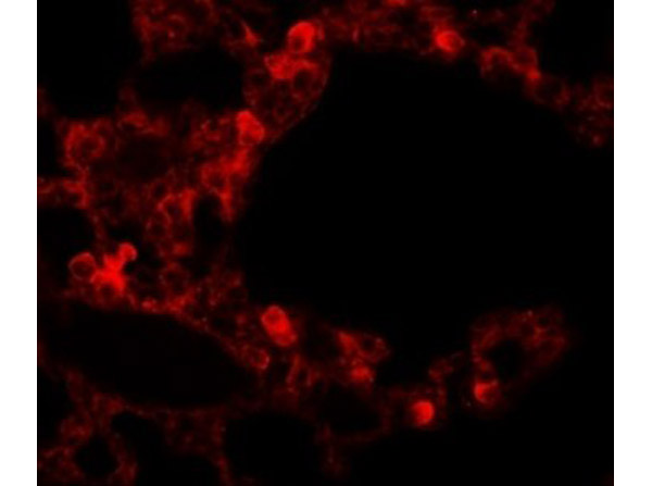 Immunofluorescence of RBM35B