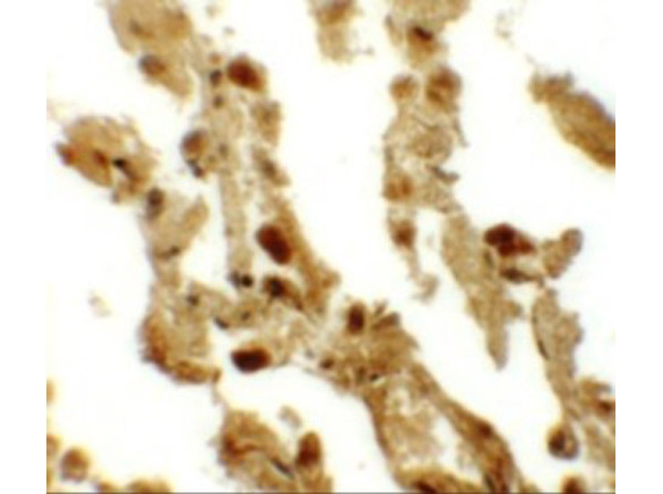 Immunohistochemistry of RBM35B