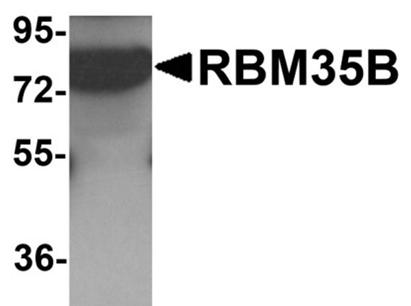 Western blot analysis of RBM35B