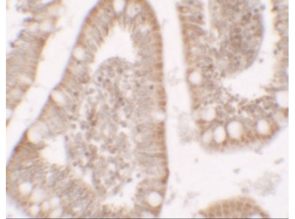 Immunohistochemistry of RC3H1