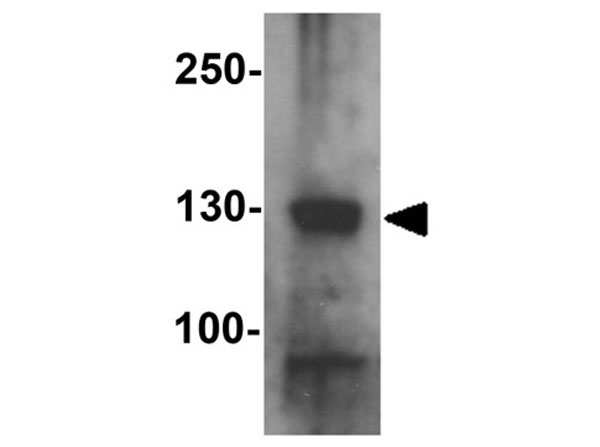 Western blot analysis of RC3H1