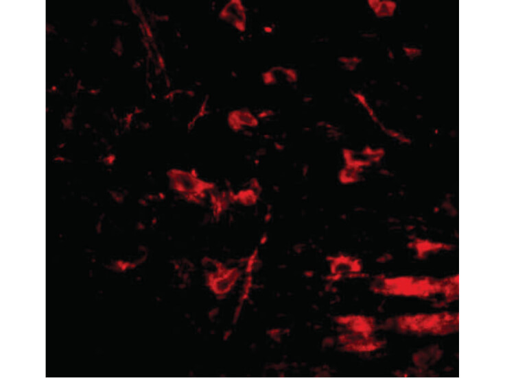 Immunofluorescence of RCAN2 Antibody