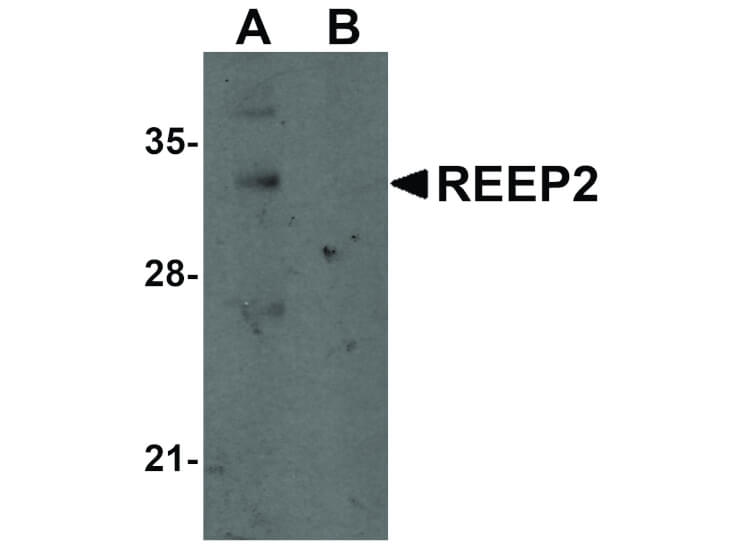 Western Blot of REEP2 Antibody