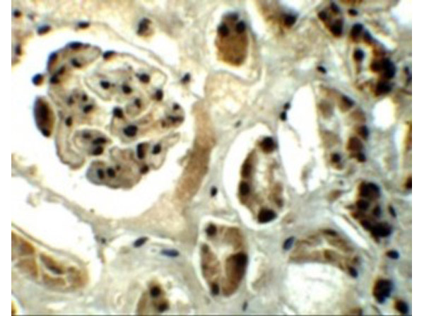 Immunohistochemistry of REQUIEM