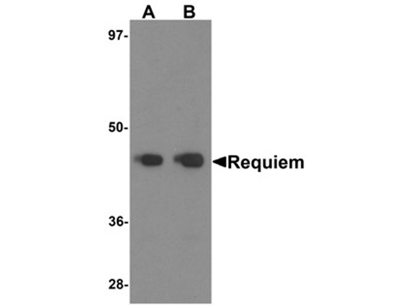 Western blot analysis of REQUIEM