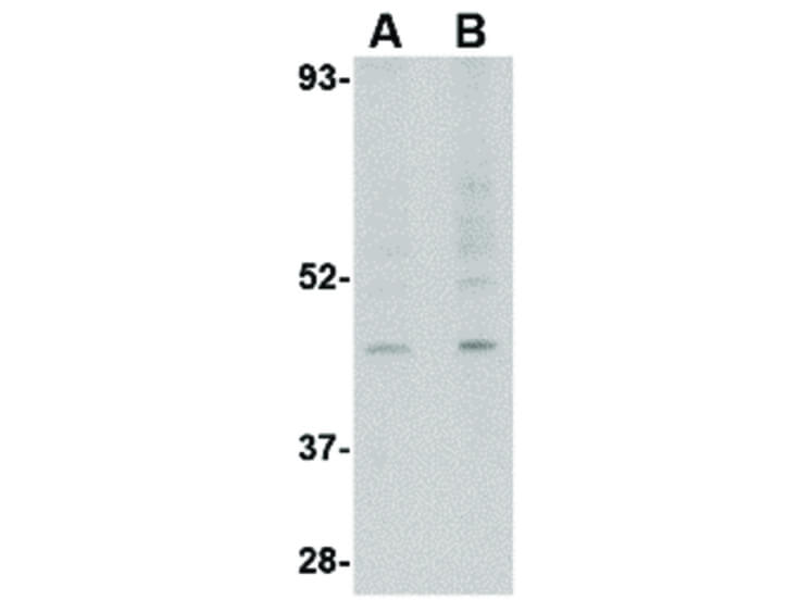 Western Blot of RGP1 Antibody