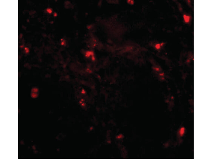 Immunofluorescence of RGPD5 Antibody