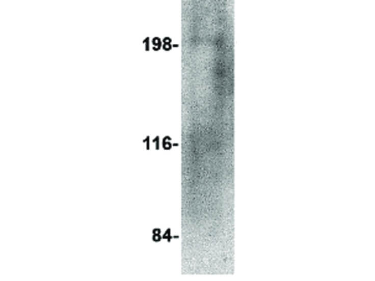 Western Blot of RGPD5 Antibody