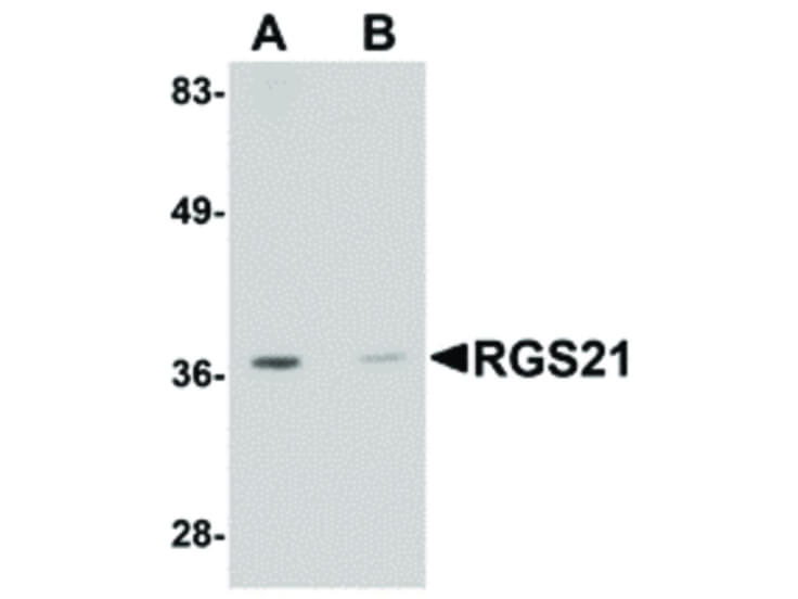 Western Blot of RGS21 Antibody