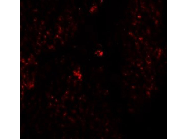 Immunofluorescence of RHAMM