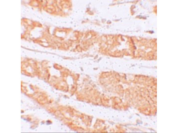 Immunohistochemistry of RHAMM