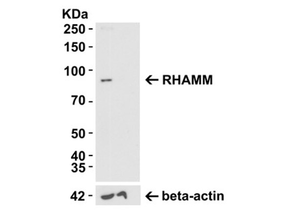 KO Validation of RHAMM