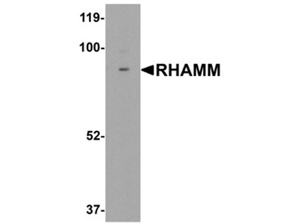 Western blot analysis of RHAMM