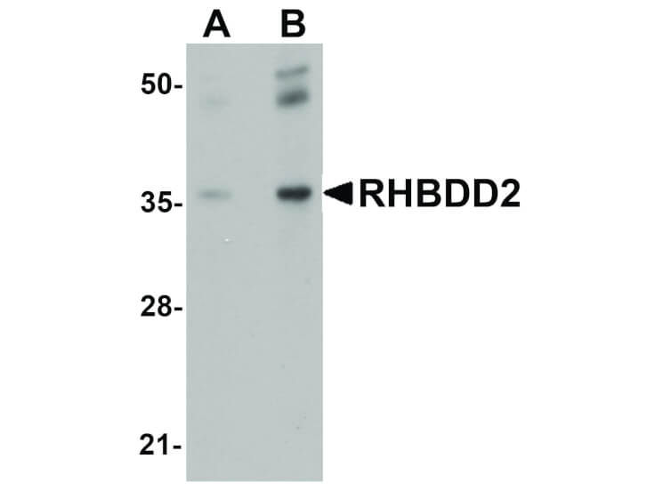Western Blot of RHBDD2 Antibody