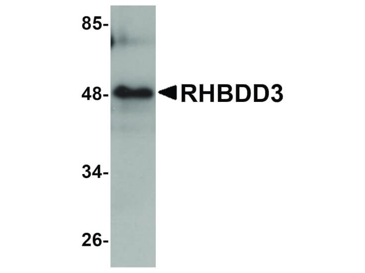 Western Blot of RHBDD3 Antibody