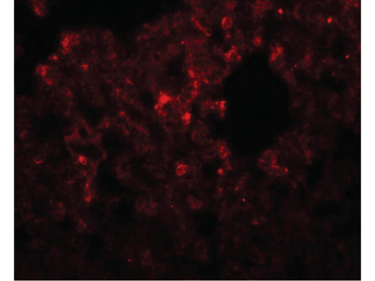 Immunofluorescence of RHBDD3 Antibody