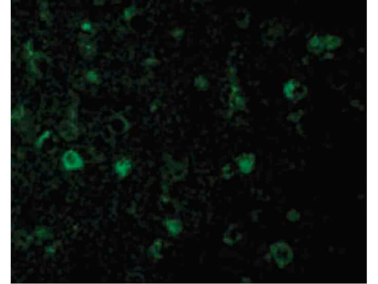 Immunofluorescence of Rheb Antibody