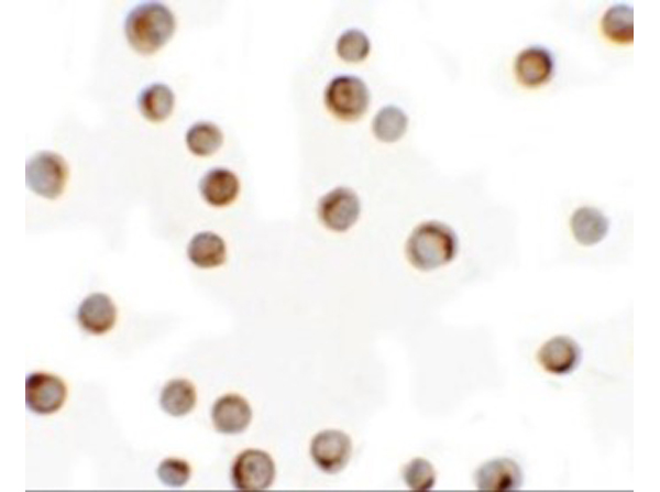 Immunocytochemistry of RILP