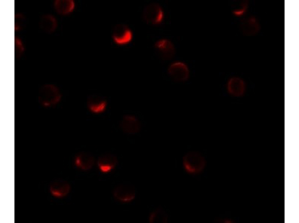 Immunofluorescence of RILP