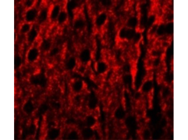 Immunofluorescence of RILPL1