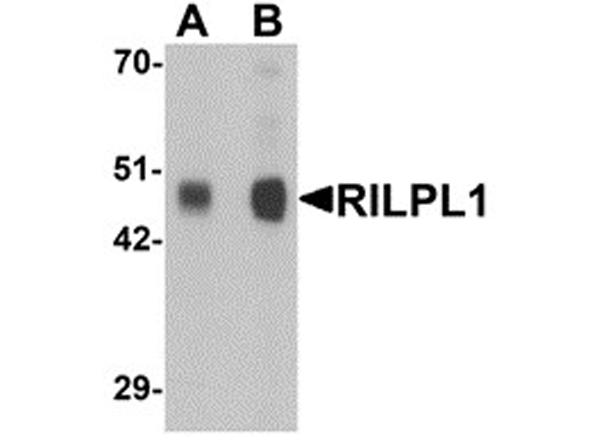 Western blot analysis of RILPL1