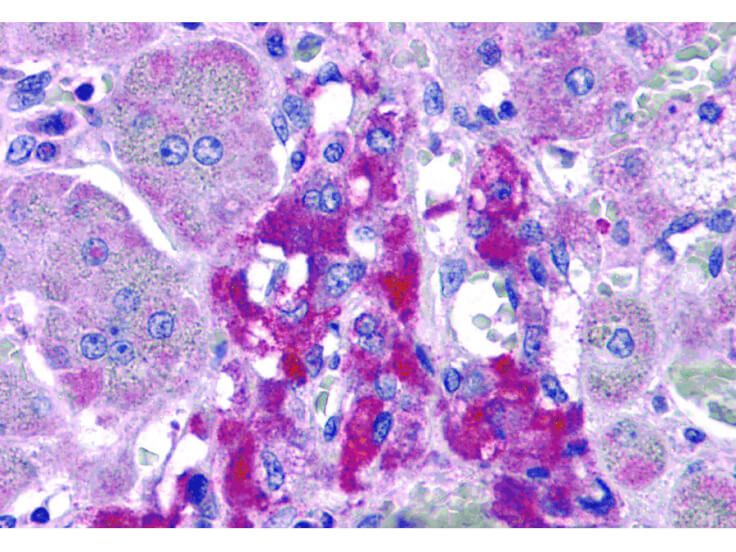 Immunohistochemistry of RIM2 Antibody