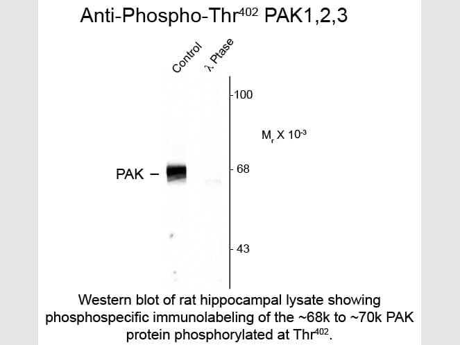 Western blot of Anti-PAK 1/2/3 pT402 (Rabbit) Antibody - 612-401-E05