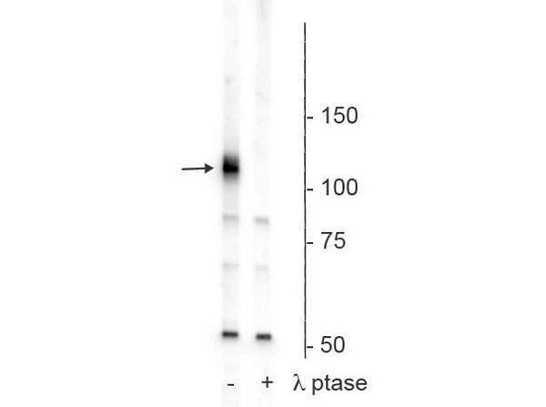 Western blot of Anti-Polo-Like Kinase pS482/pS486/pS490 Antibody.