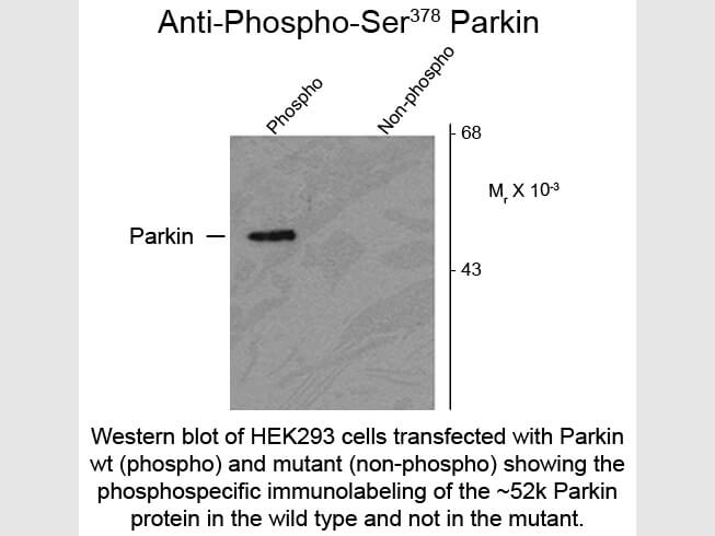 Western blot of Anti-Parkin pS378 (Rabbit) Antibody - 609-401-E07